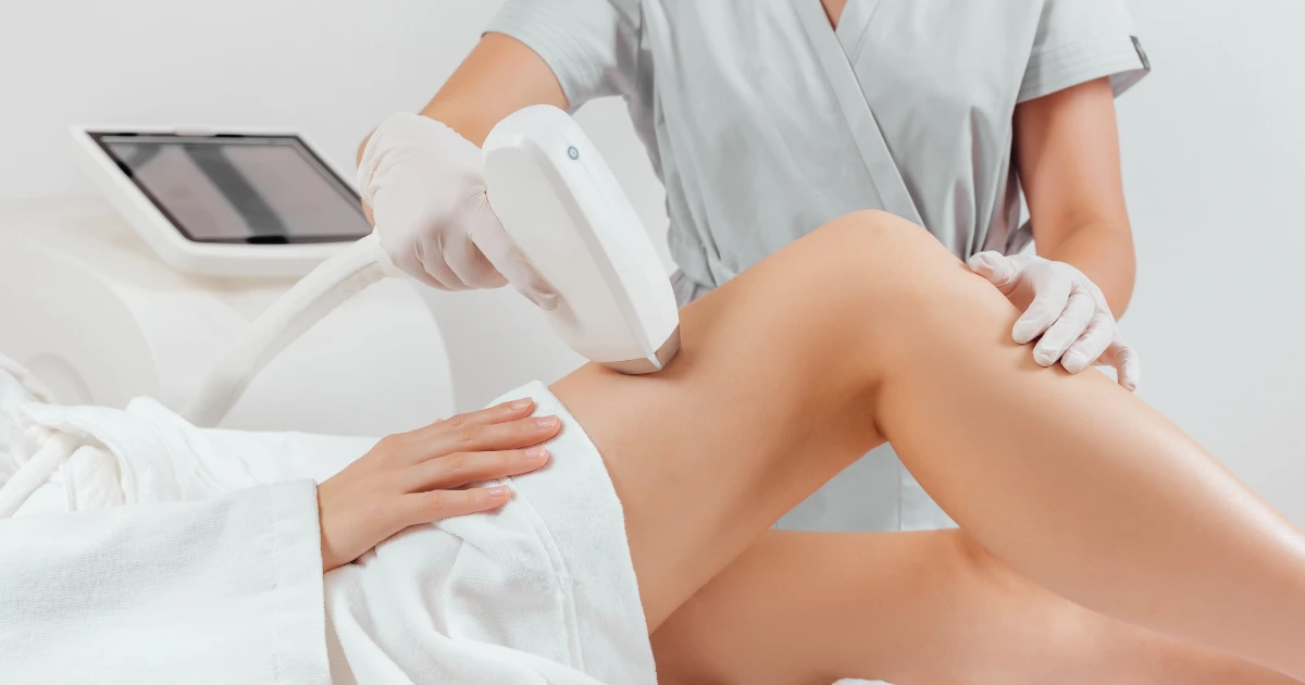 laser hair removal in Baton Rouge, LA